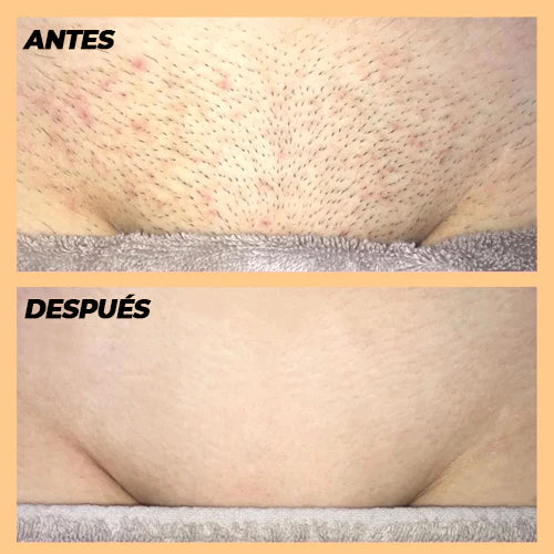 FULL EPILATOR PRO - DEPILADORA LÁSER PIEL PERFECTA