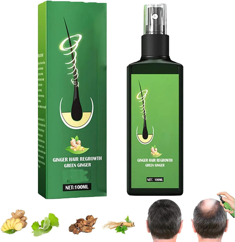 🚚 PAGO CONTRAENTREGA 🚚 Aceite Crecimiento Cabello 10X más rápido + ENVIO GRATIS